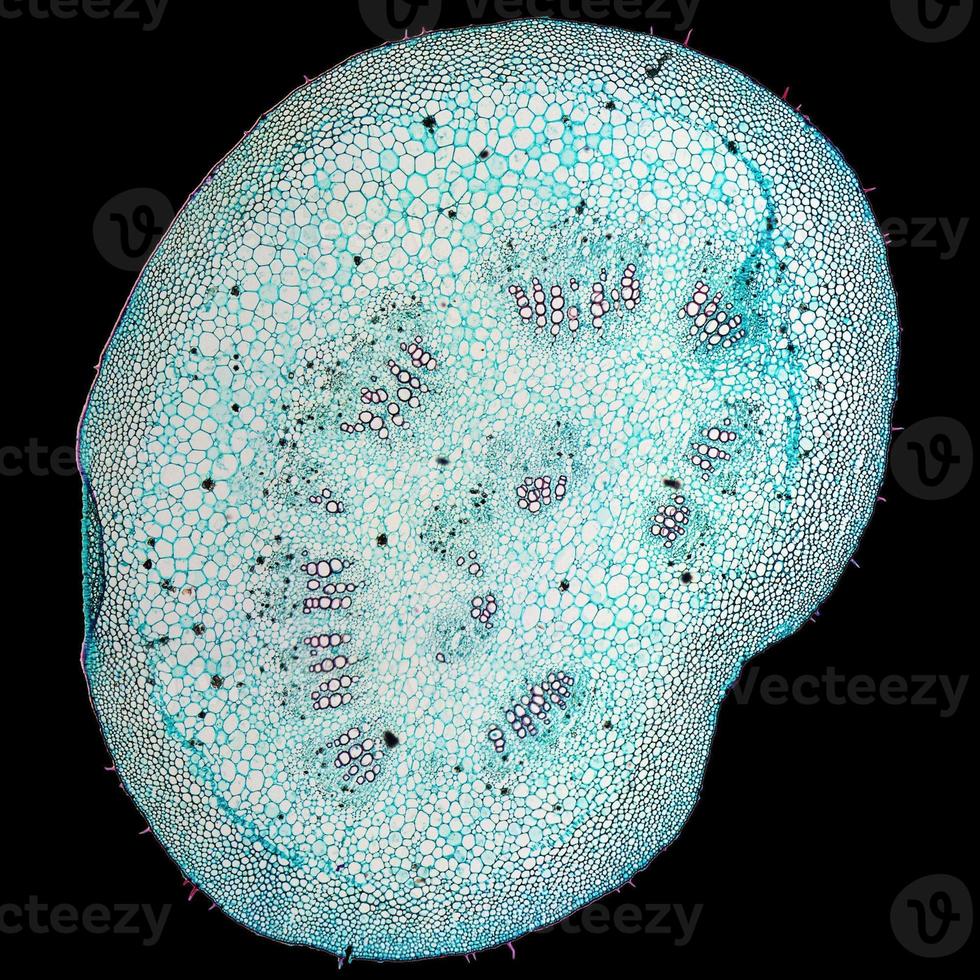 Mulberry cells micrograph photo