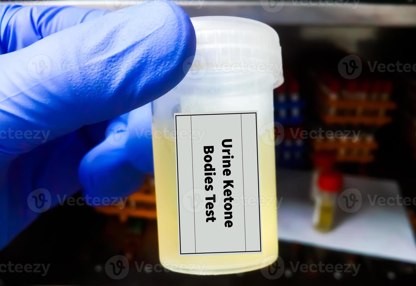 Medical Technologist hold container with urine sample for urine ketone bodies test photo