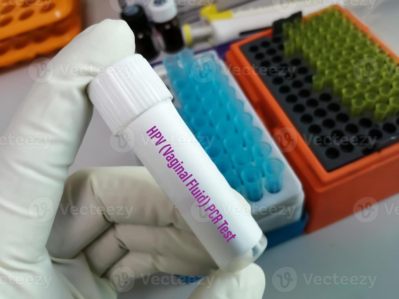 Scientist holding sample container with Cervical Fluid sample for PCR HPV DNA test, Human papilloma virus, cervical cancer. A medical testing concept in the laboratory photo