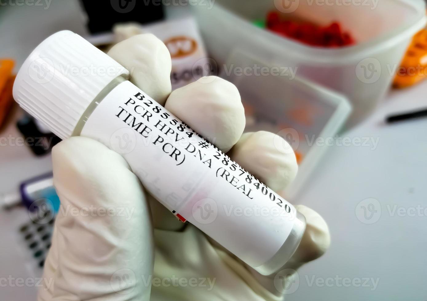 Scientist holding sample container with Cervical Fluid sample for PCR HPV DNA test, Human papilloma virus, cervical cancer. A medical testing concept in the laboratory photo