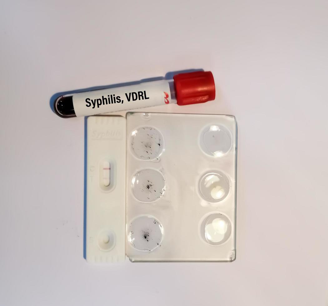 VDRL, TPHA text on test tube with RPR glass slide agglutination method and rapid screening cassette for syphilis isolated on white background, showing reactive and nonreactive result. photo