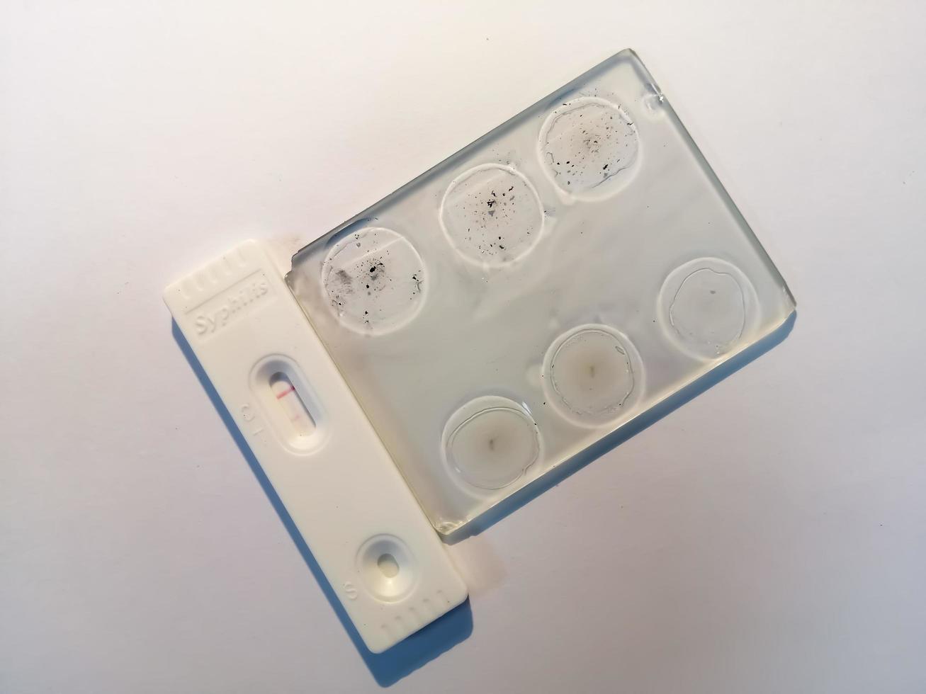 VDRL, TPHA. RPR glass slide agglutination method and rapid screening cassette for syphilis isolated on white background, showing reactive result. photo