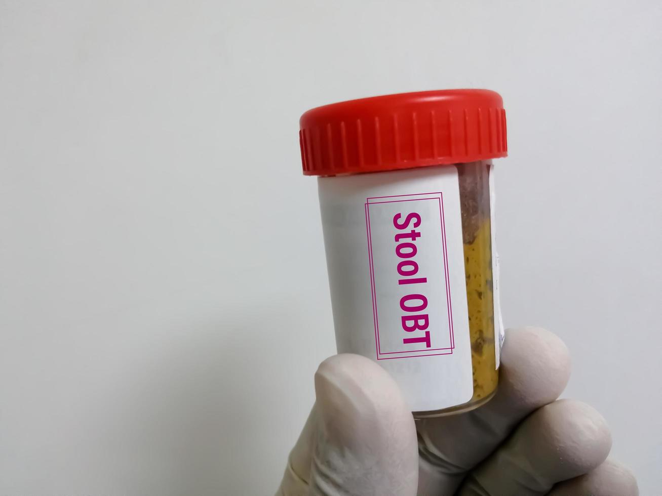 Doctor holding stool sample container for occult blood test photo