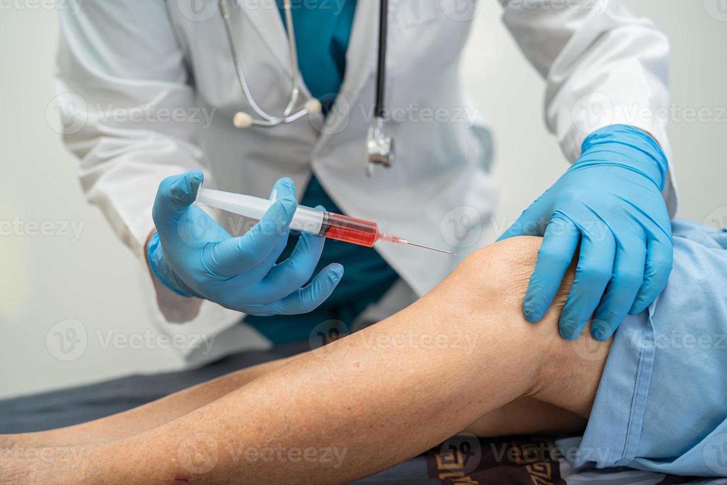 médico asiático inyecta ácido hialurónico plasma rico en plaquetas en la rodilla de una mujer mayor para caminar sin dolor. foto