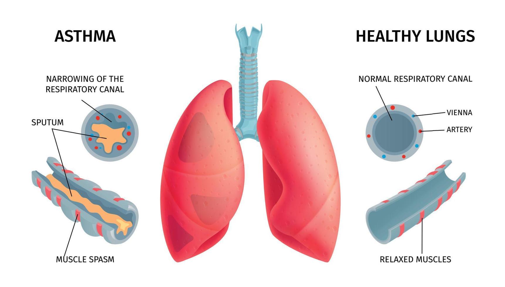 infochart de anatomía del pulmón humano vector