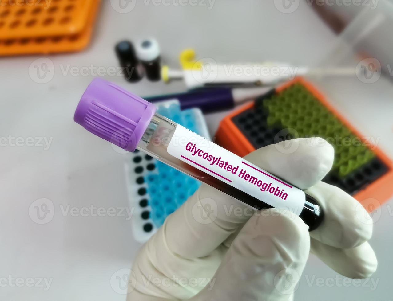 Blood sample for glycosylated hemoglobin test with laboratory background. Hba1c. hemoglobin A1c photo