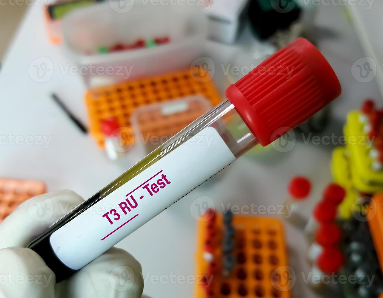 Blood sample tube for T3 RU test. T3 resin uptake test measures the level of proteins that carry thyroid hormone in the blood photo