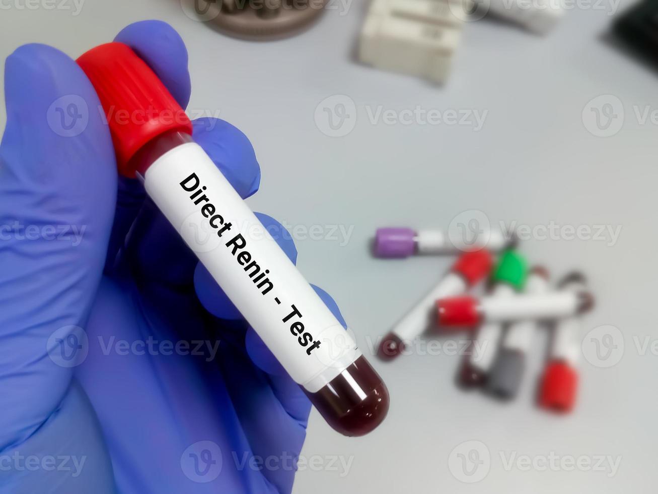 Blood sample tube for Direct renin test. CKD. Renin's primary function is therefore to eventually cause an increase in blood pressure, leading to restoration of perfusion pressure in the kidneys photo