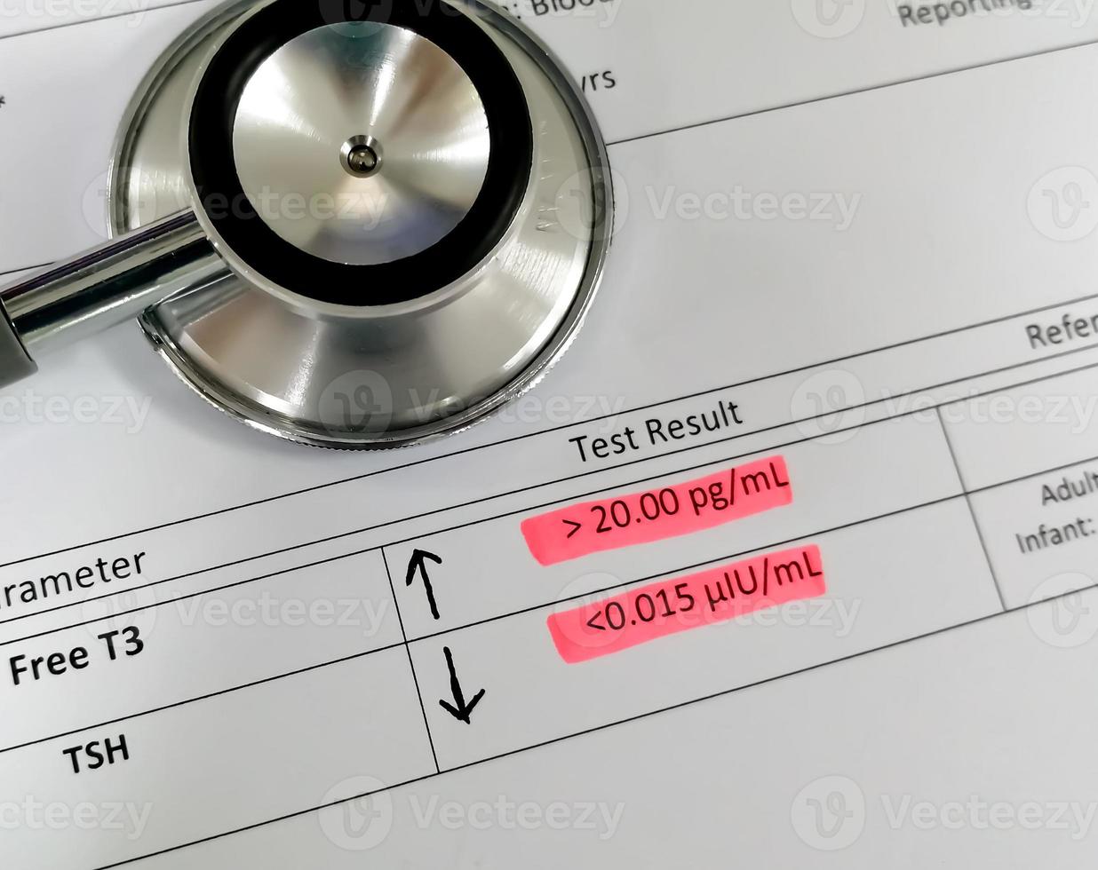 Abnormal thyroid report isolated with stethoscope. Hyperthyroidism. Abnormal Free T3 and TSH test. photo