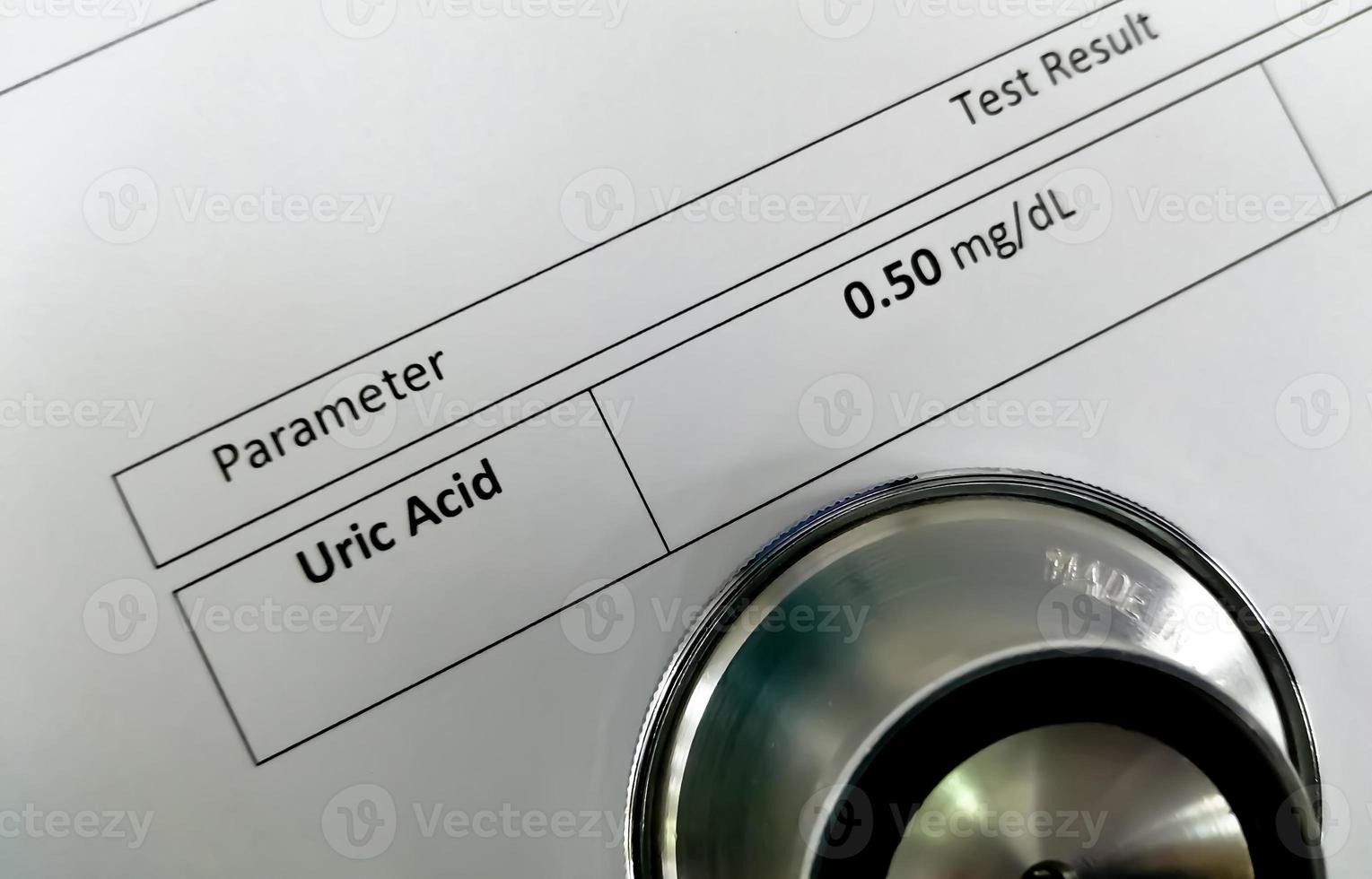 Stethoscope isolated with abnormal low uric acid test result report. photo