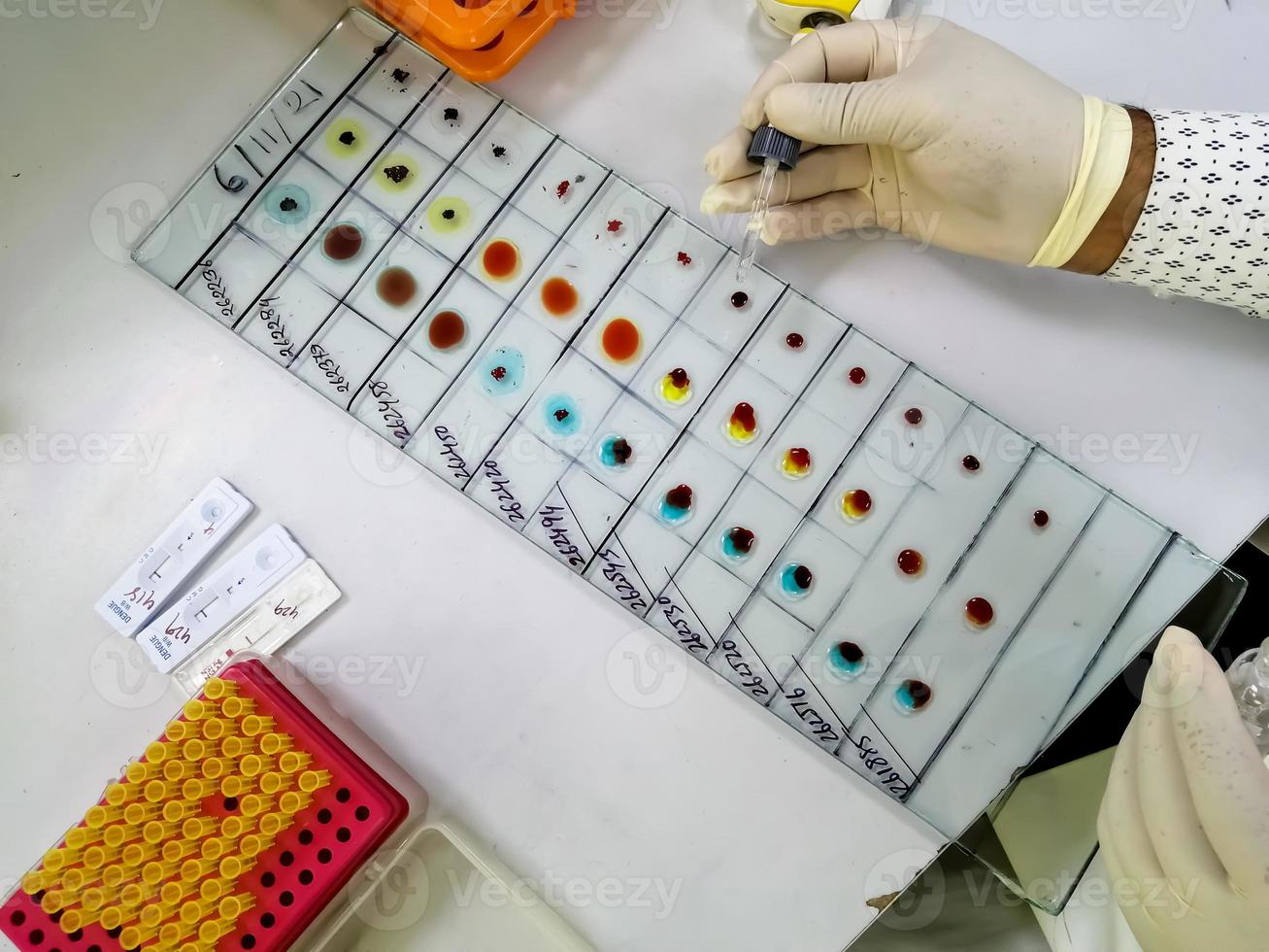 ABO blood grouping by slide test technique. Technician performing blood grouping. photo