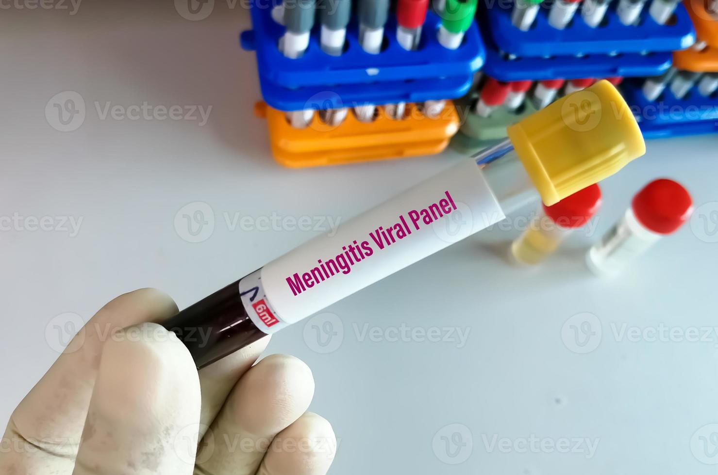 Blood sample for Meningitis viral panel test with laboratory background. photo