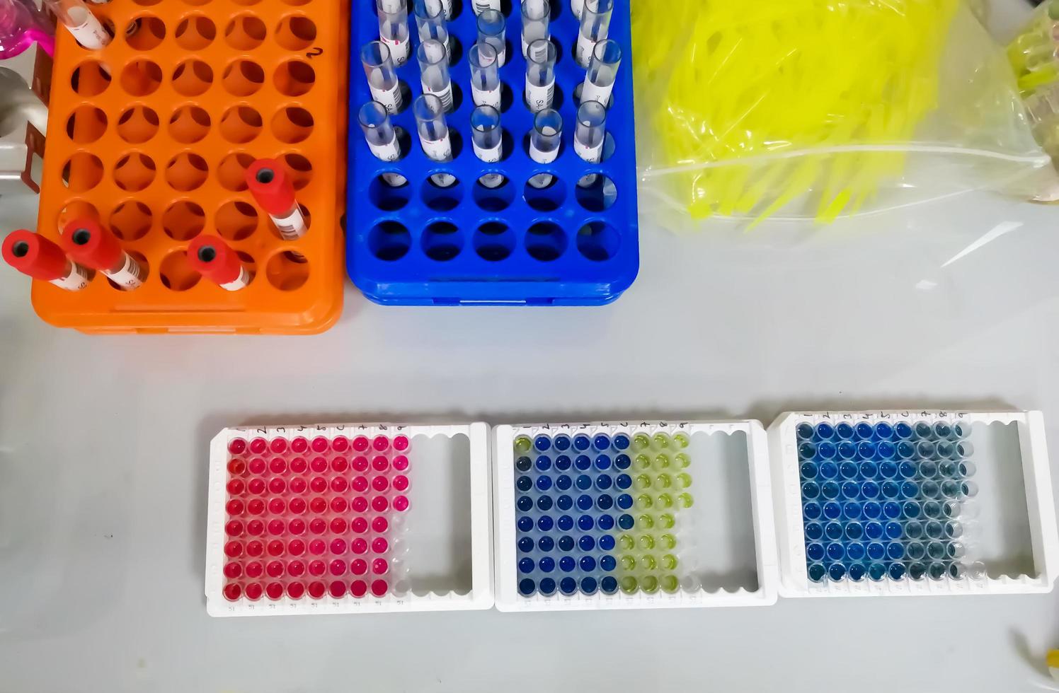 Work satiation of laboratory. ELISA plates and blood sample isolated on working table. photo