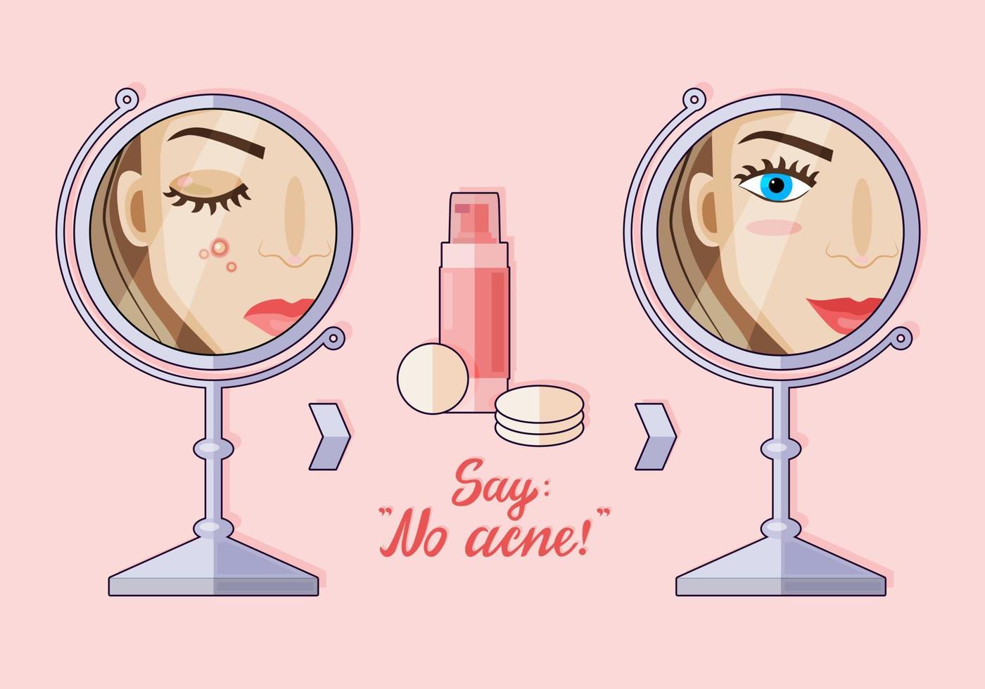 Vector illustration of a modern flat cartoon character. A girl who doesn't have skin problems. Before and after. Acne lotion. No acne.