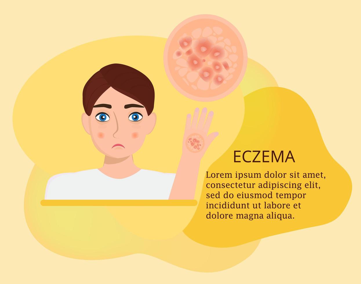 Infographics of eczema with reasons, man, pills, map, bacteria, immunity, endocrine, stress signes. vector