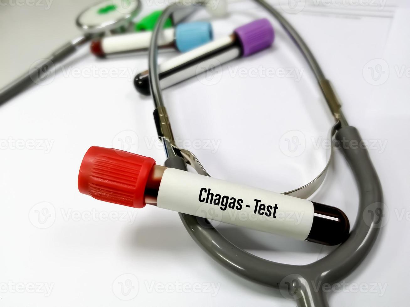 tubo de ensayo con muestra de sangre para la prueba de chagas, tripanosomiasis americana. diagnóstico de la enfermedad de chagas. un concepto de pruebas médicas en el laboratorio. foto