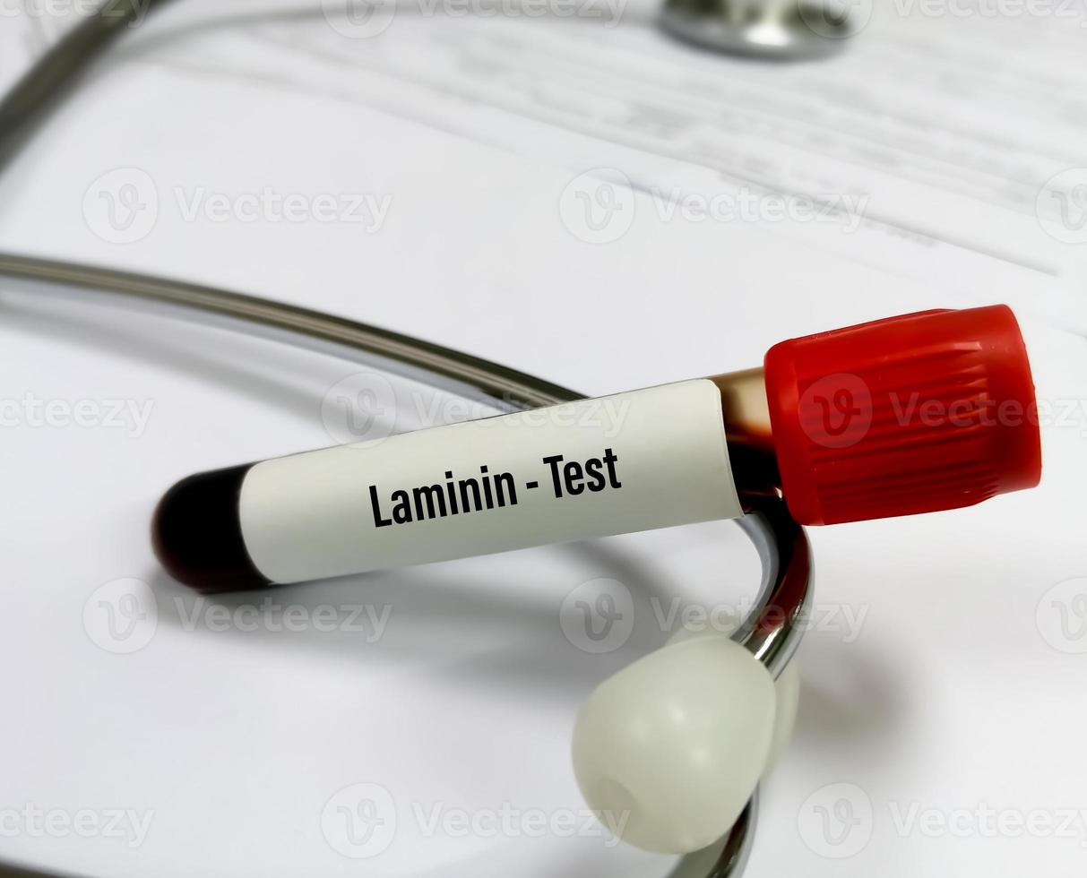 muestra de sangre para la prueba de laminina. prueba anti-laminina 332. anticuerpo de la zona de la membrana foto