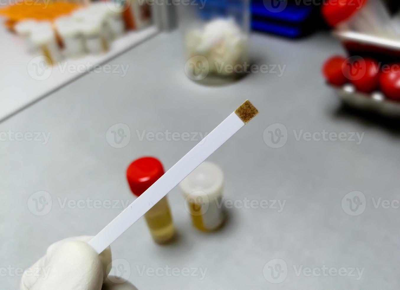 Hand holding Glucose strip showing abnormal result with laboratory background. urine sugar test. urinalysis. photo