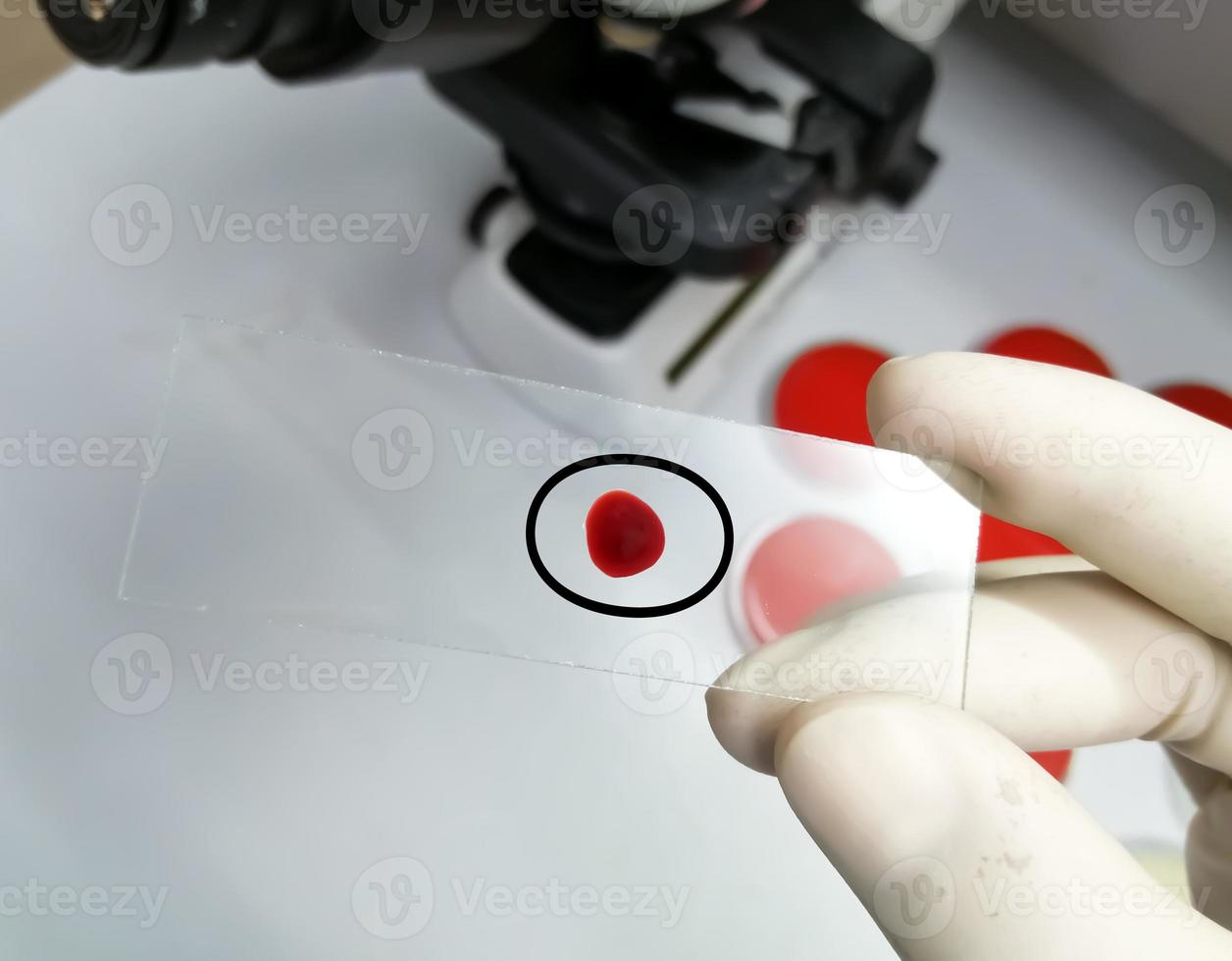 Hand of scientist hold glass slide with a drop of blood for further laboratorical testing. photo