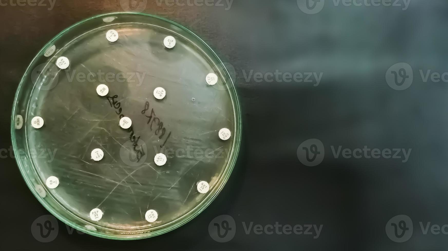 Antimicrobial susceptibility testing in petri dish. Antibiotic resistance of bacteria photo