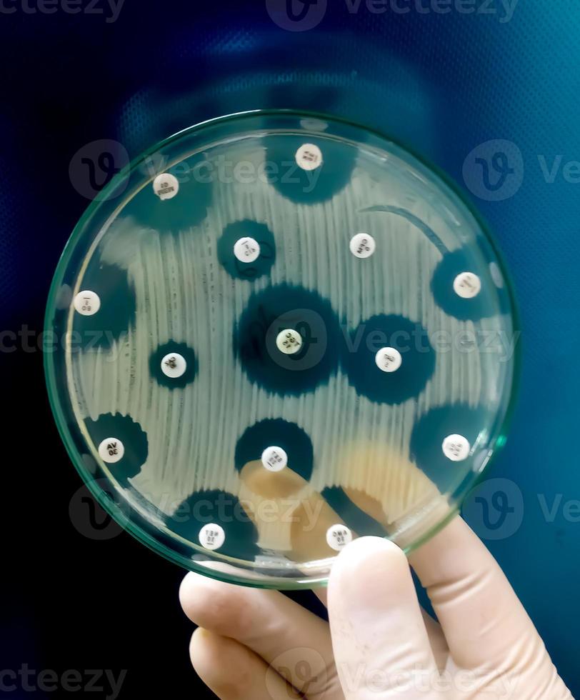 Pruebas de susceptibilidad a los antimicrobianos en placa de Petri. resistencia a los antibióticos de las bacterias foto
