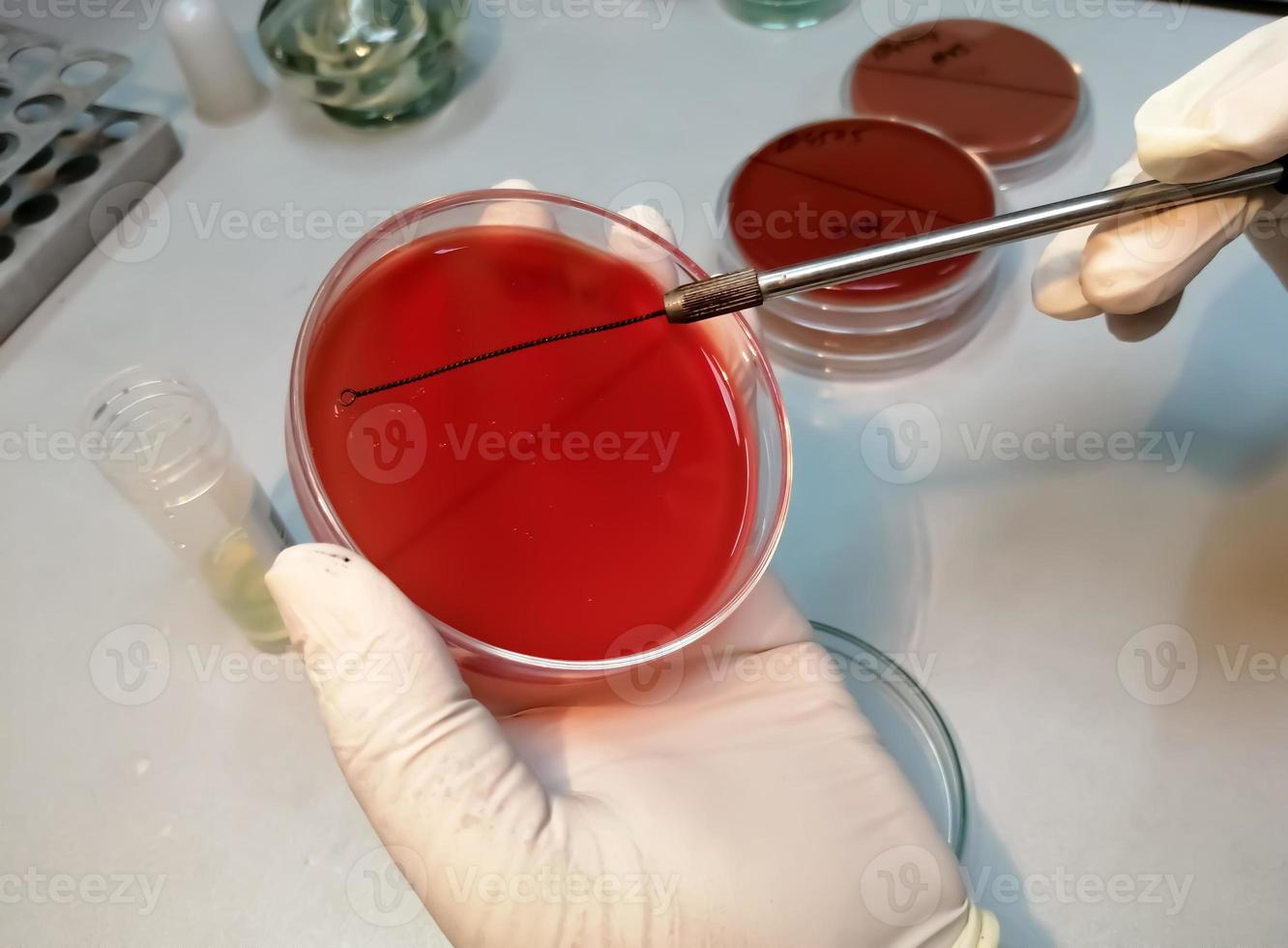 Microbiology, technician working with bacteria strains photo