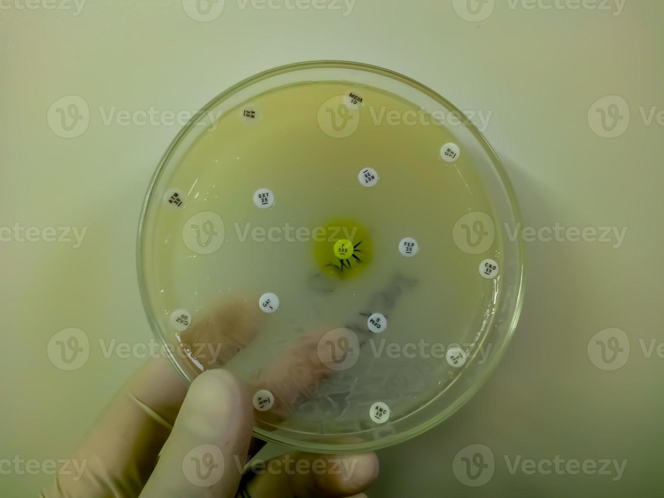 Antimicrobial susceptibility testing in petri dish. Antibiotic resistance of bacteria photo