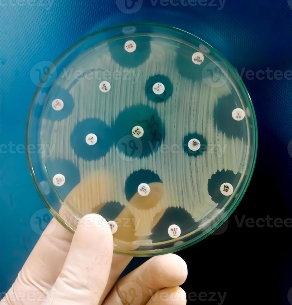 Pruebas de susceptibilidad a los antimicrobianos en placa de Petri. resistencia a los antibióticos de las bacterias foto