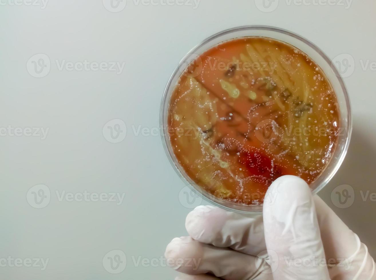 científico o médico con placa de Petri con colonia bacteriana. enterobacter spp. cultura Urina. vista cercana. foto