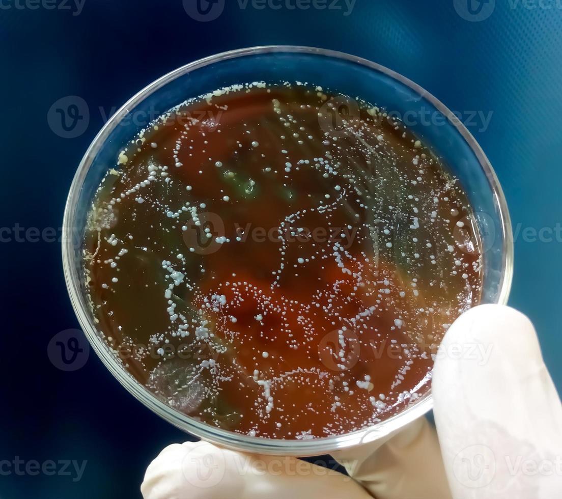 Scientist or doctor holding Petri Dish with bacterial colony. Enterobacter spp. Urine culture. close view . photo