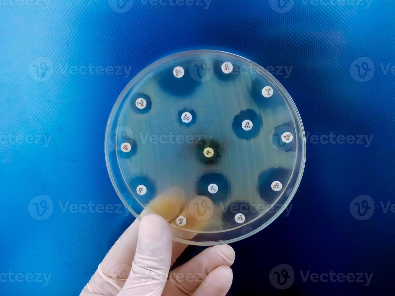 Antimicrobial susceptibility testing in petri dish. Antibiotic resistance of bacteria photo