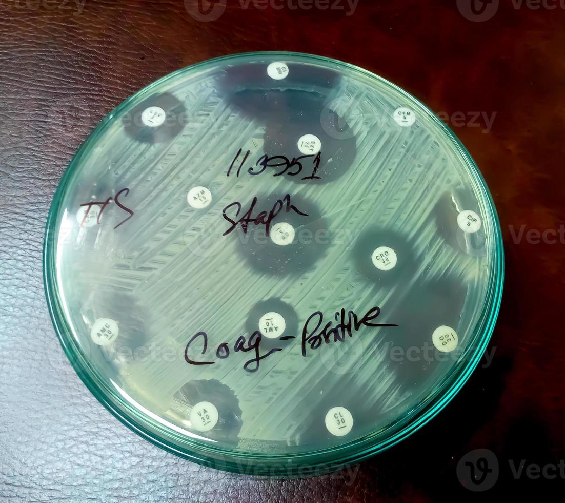 Antimicrobial susceptibility testing in petri dish. Antibiotic resistance of bacteria photo