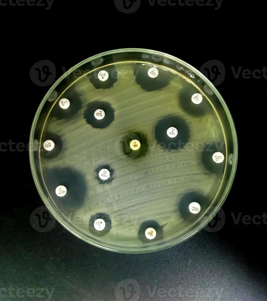 Antimicrobial susceptibility testing in petri dish. Antibiotic resistance of bacteria photo