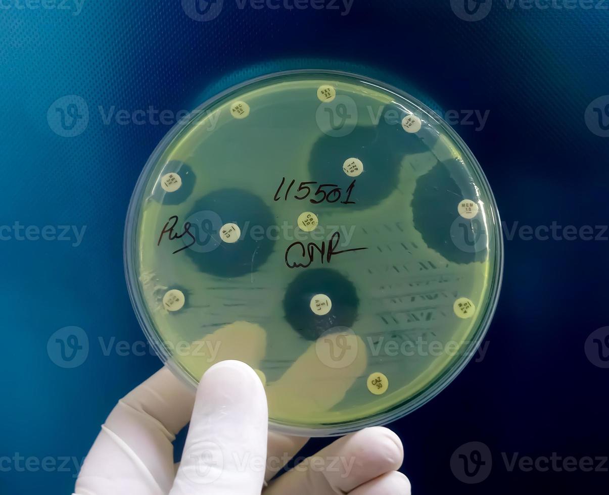 Antimicrobial susceptibility testing in petri dish. Antibiotic resistance of bacteria photo