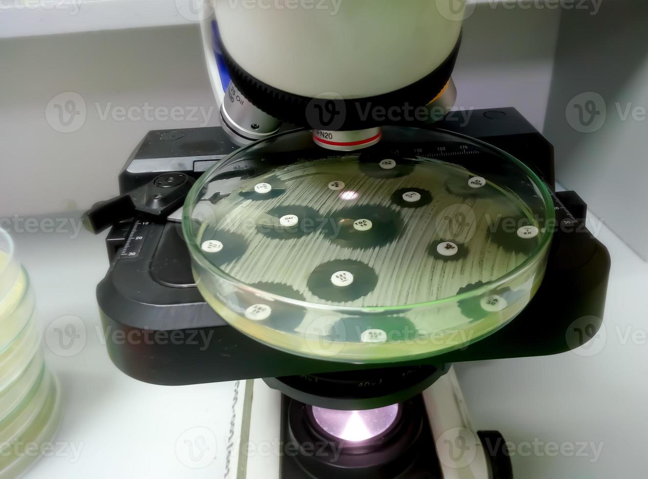 Antimicrobial susceptibility testing in petri dish. Antibiotic resistance of bacteria photo