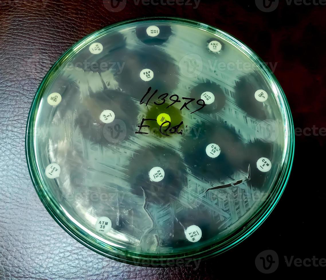 Antimicrobial susceptibility testing in petri dish. Antibiotic resistance of bacteria photo