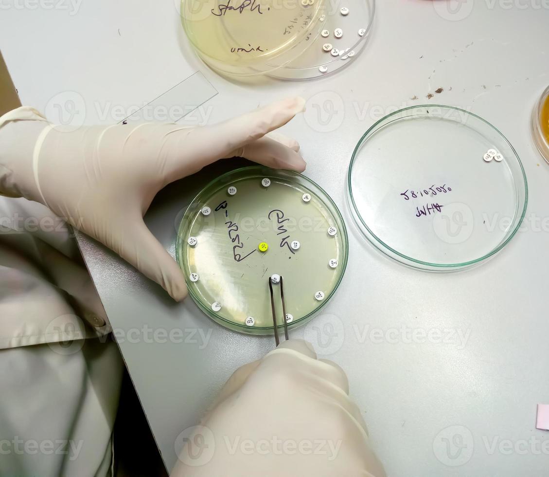El científico o el microbiólogo colocan un disco de antibióticos, diagnóstico de resistencia a los antibióticos del microorganismo. foto