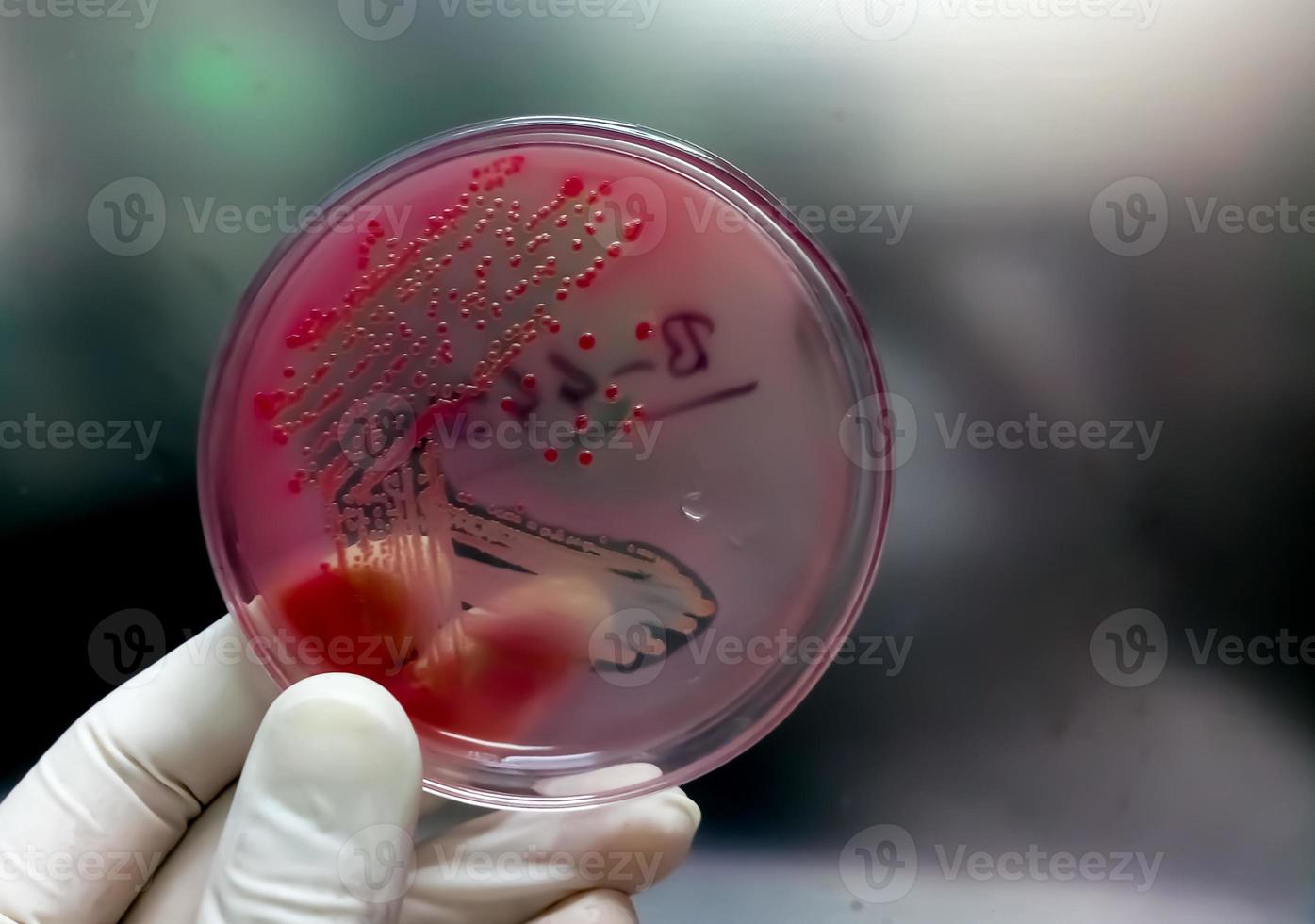 colonias de bacterias en agar macconkey. placa de medio de cultivo. placa de Petri foto