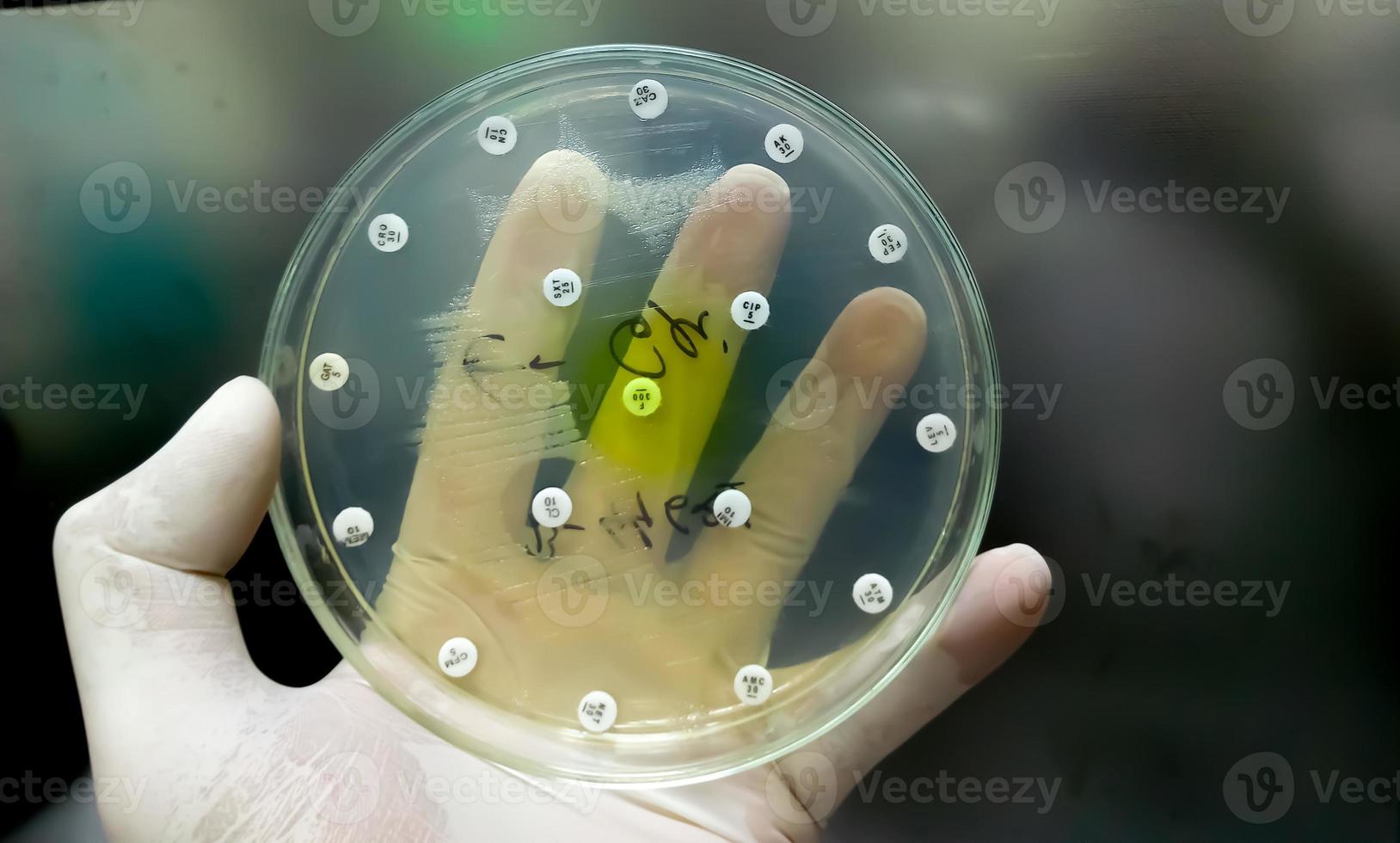 Antimicrobial susceptibility testing in petri dish. Antibiotic resistance of bacteria photo