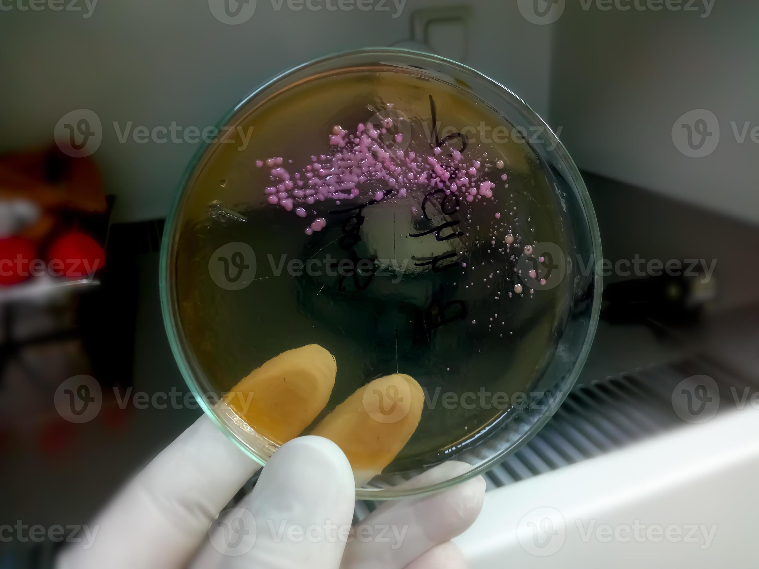 Bacteria colony in culture media plate. Stool culture, E.coli 4966524