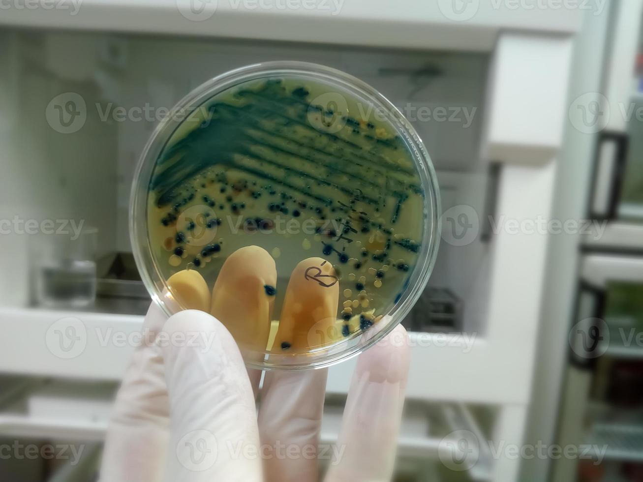 Mano enguantada de un técnico o científico sosteniendo una placa de Petri en el fondo de un laboratorio de microbiología. medios de cultivo bacteriano. microbiólogo. bacterias. foto