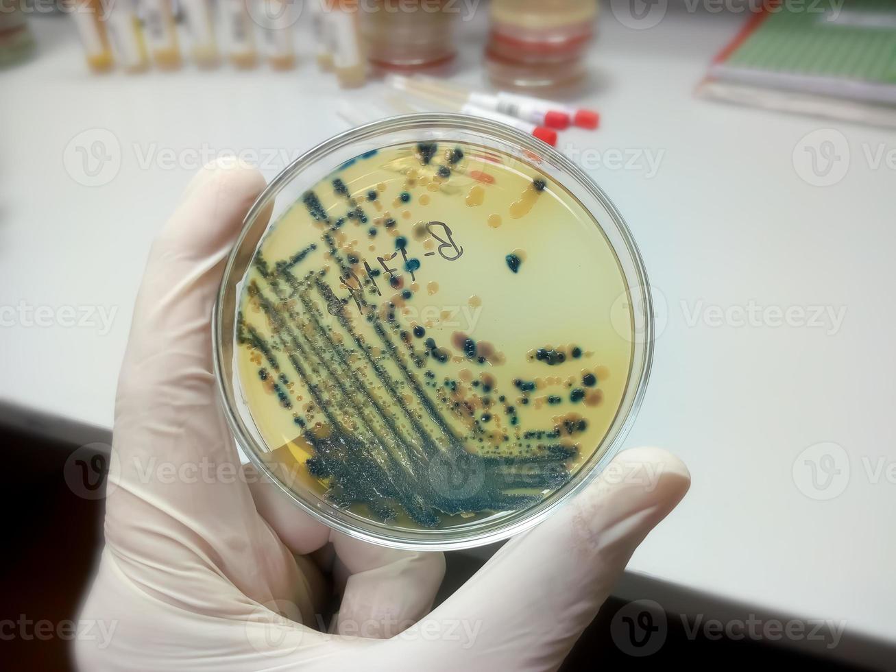 Gloved Hand of a Technician or scientist holding petri dish in the background of a microbiology laboratory. Bacterial Culture Media. Microbiologist. Bacteria. photo