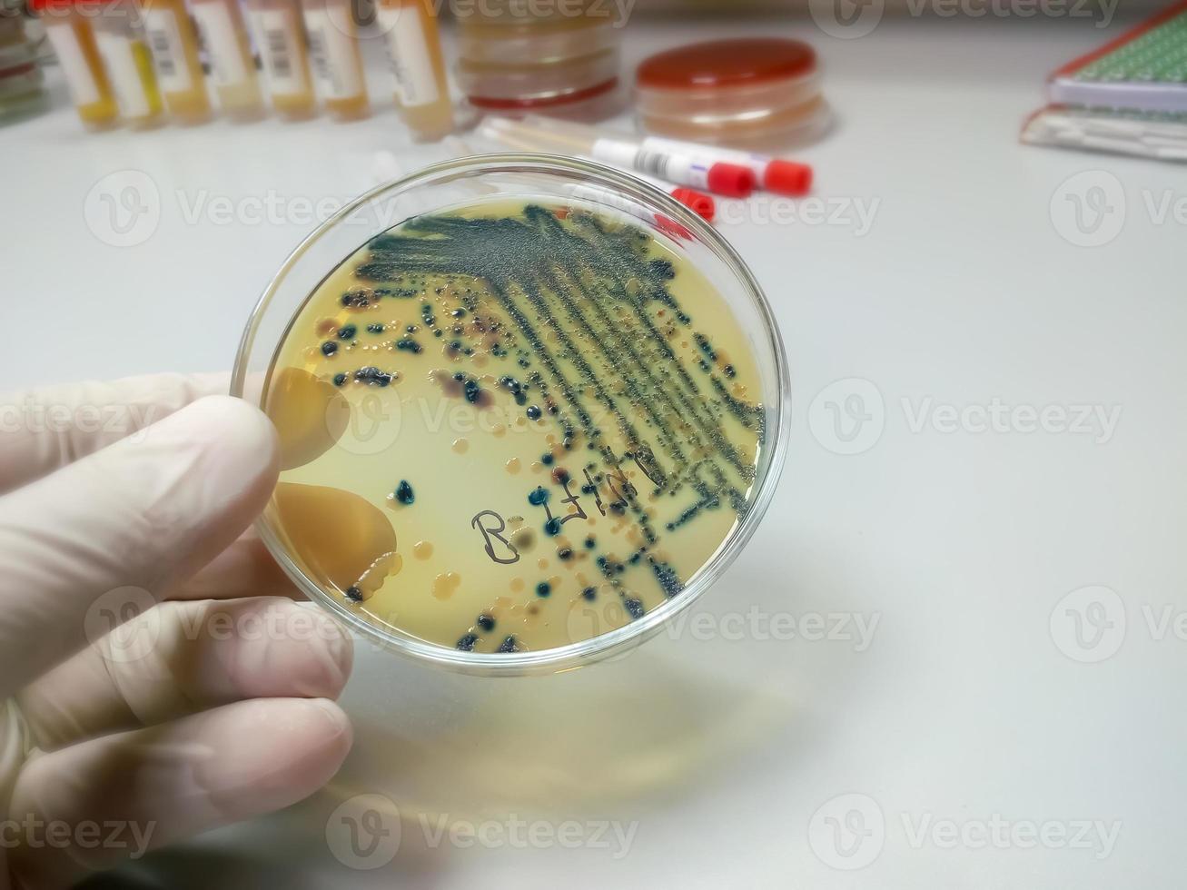 Gloved Hand of a Technician or scientist holding petri dish in the background of a microbiology laboratory. Bacterial Culture Media. Microbiologist. Bacteria. photo