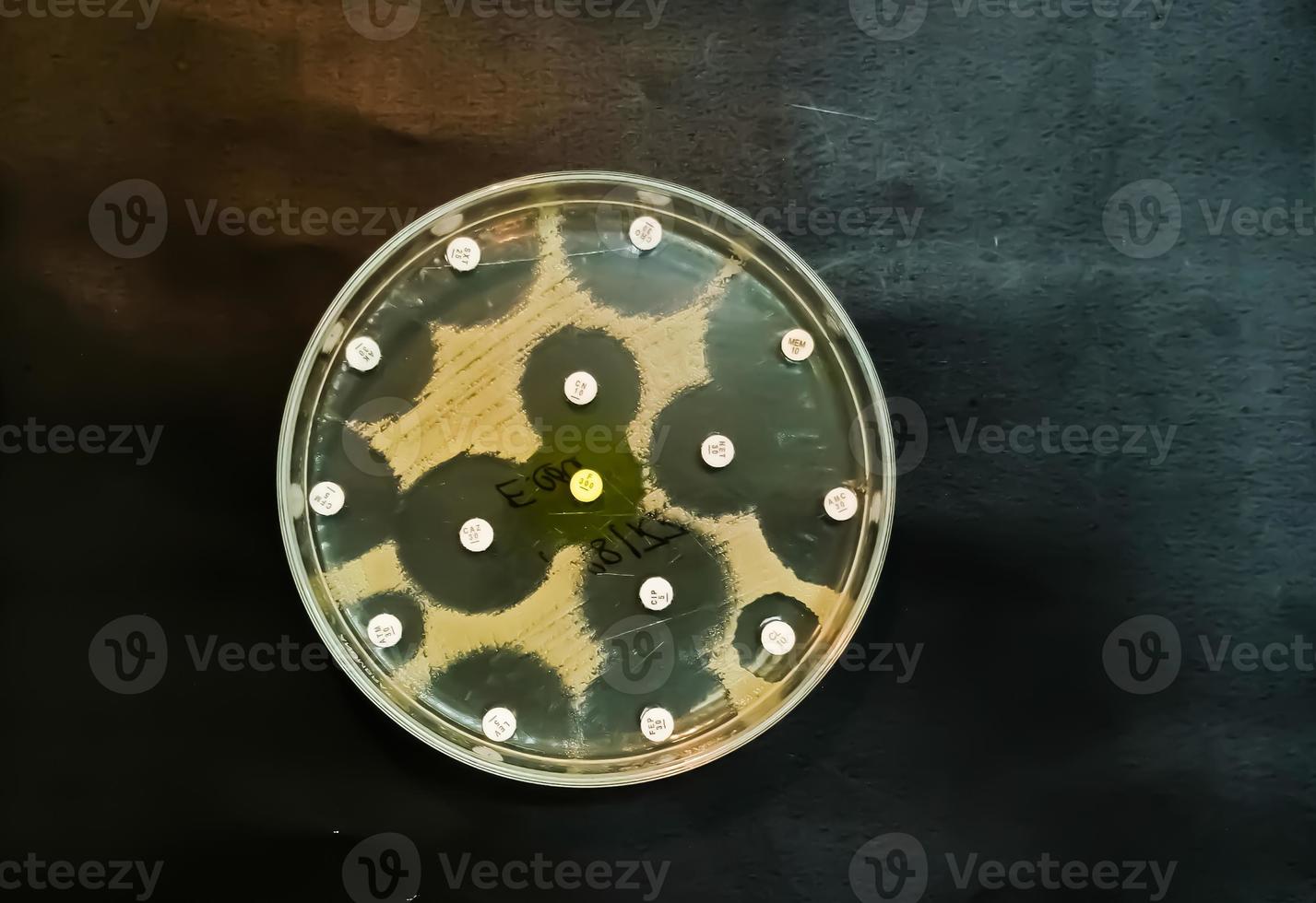 Antimicrobial susceptibility testing in petri dish. Antibiotic resistance of bacteria photo