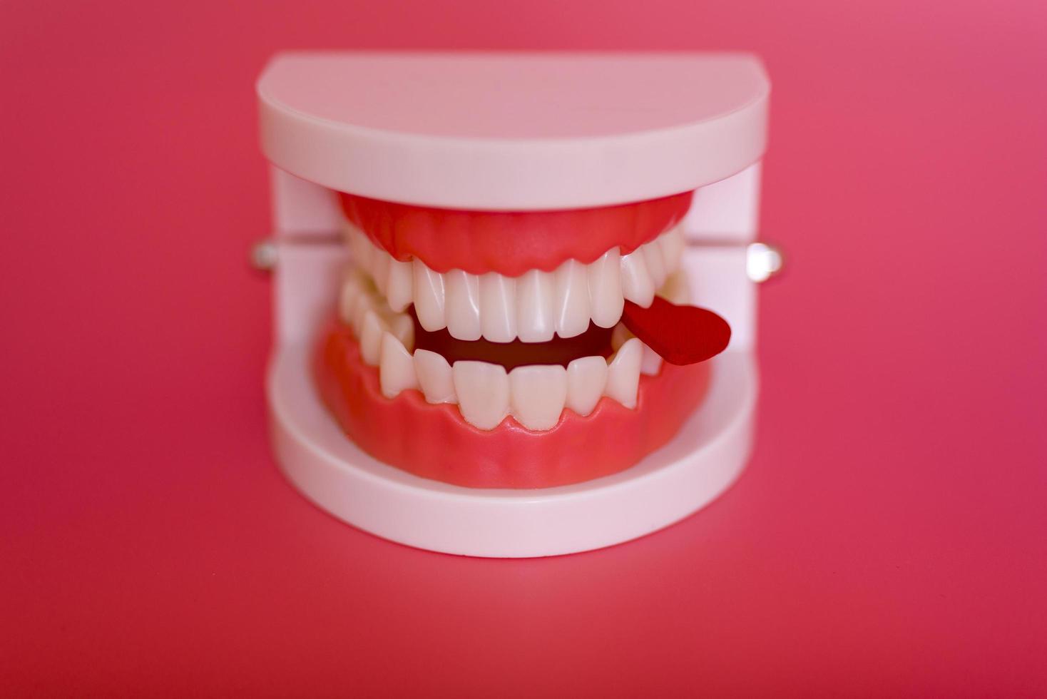 divertido modelo dental de ortodoncia y corazón rojo sobre fondo rosa. modelo de demostración de dientes de diferentes tipos de aparatos de ortodoncia o aparatos ortopédicos. foto