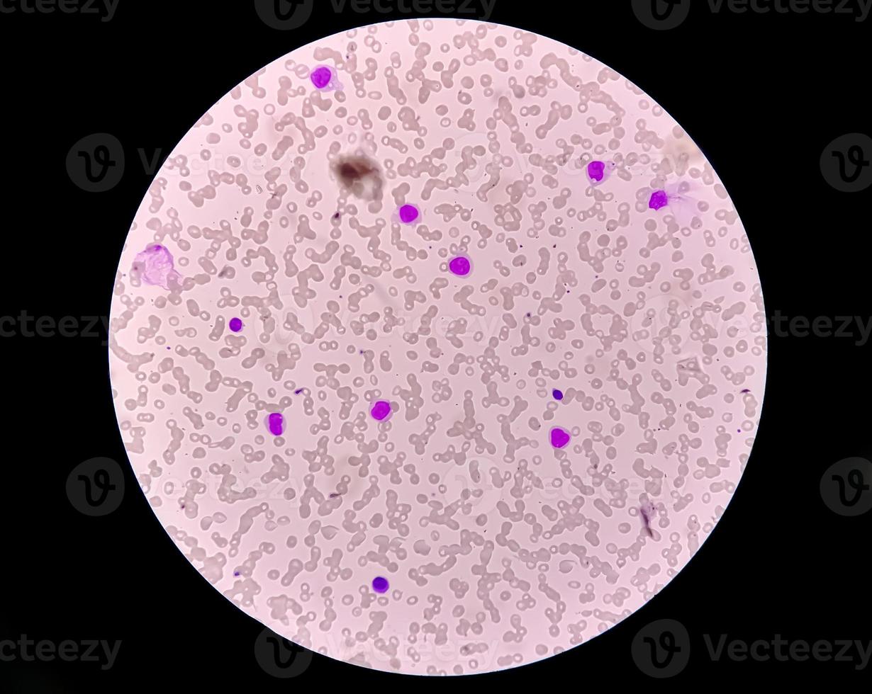 Microscopic view of Hematology slide . close view. photo