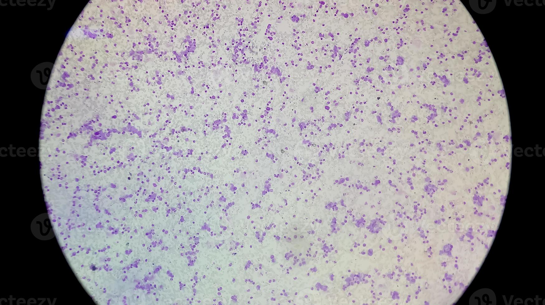 Microscopic view of Hematology slide . close view. photo