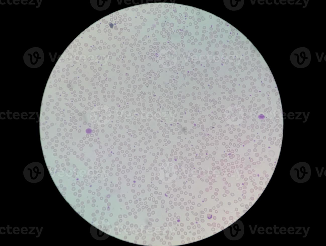 Microscopic view of Hematology slide . close view. photo