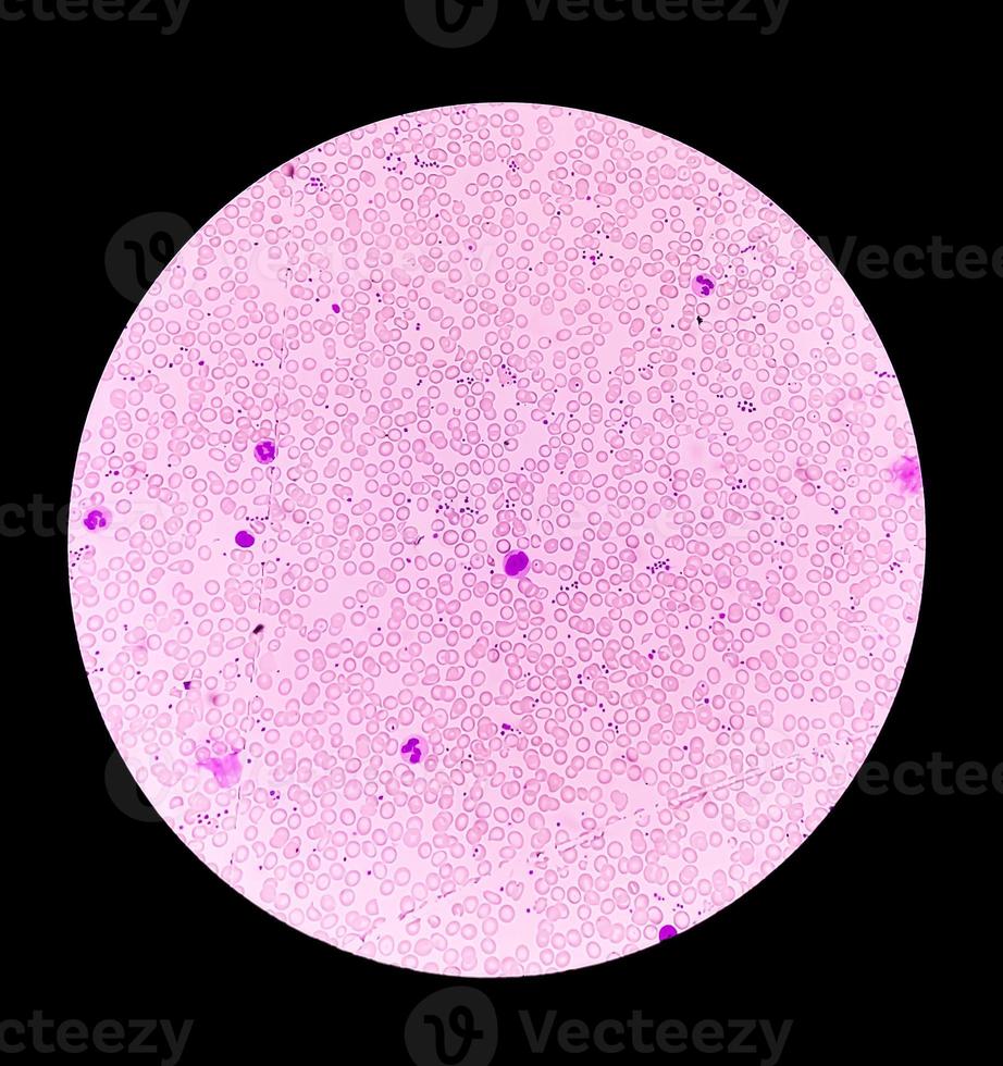 Microscopic view of Hematology slide . close view. photo