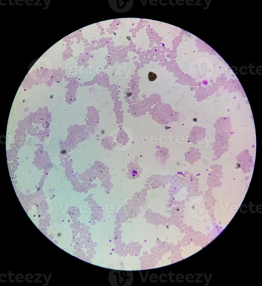 Microscopic view of Hematology slide . close view. photo